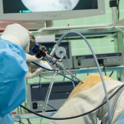 ACL Reconstruction Surgery (2)