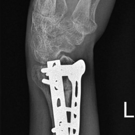 Fracture and complex trauma management treatment by orthopedic specialist